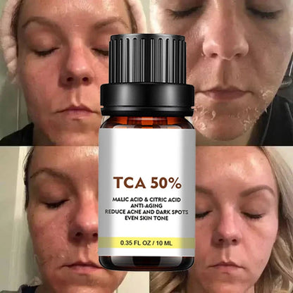 Exfoliating Peeling Oil Facial Scrub Moisturizing Whitening Nourishing Repair Beauty Skin Care Peeling Facial Essence