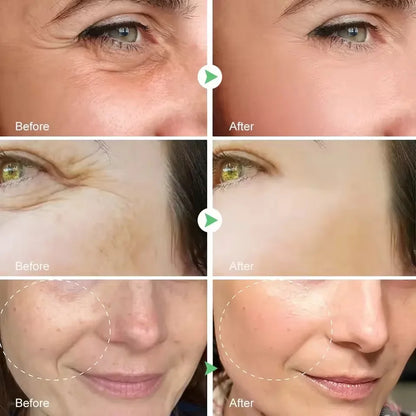 Retinol Remove Wrinkle Face Serum Lift Firming Anti Aging Fade Fine Lines Whitening Brightening Moisturizer Skin Care Cosmetics