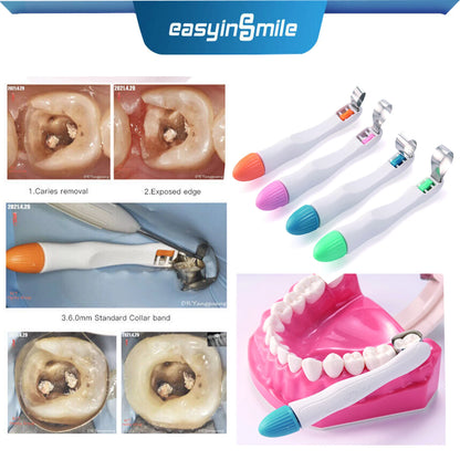 10/50pcs Dental Pro Matrix Bands Easyinsmile Preformed Adjustable Ring Matrices Molar Premolar 4.5/6MM Standard and Curved